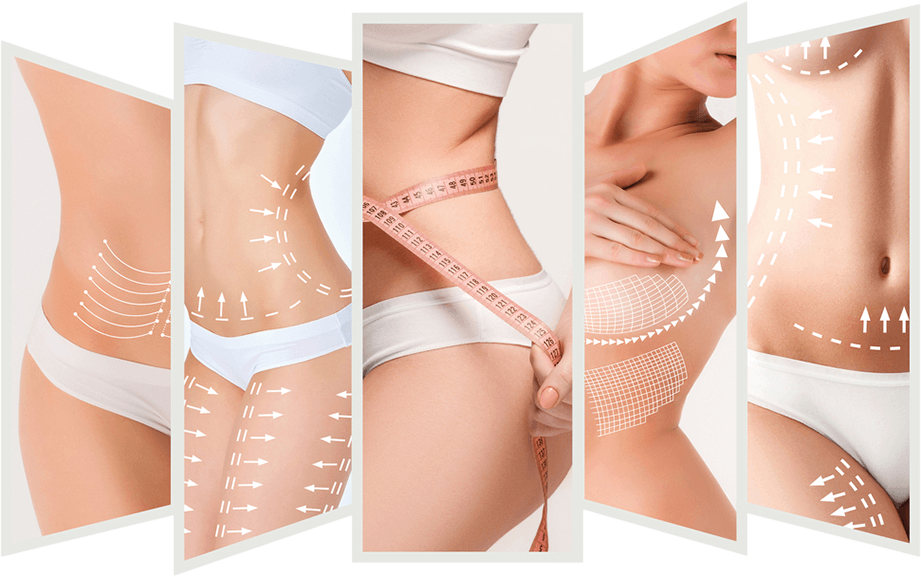 Aqualyx – Fat Dissolving Injections at Pixel Perfect in Harley Street London and Southampton