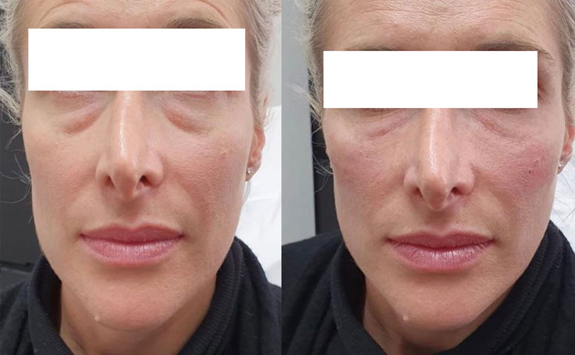 before and after