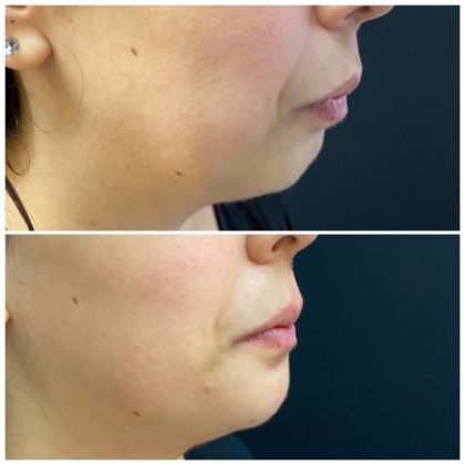 Pixel Perfect Aesthetic Clinics Southampton Pixel Perfect Aesthetic Clinics Southampton