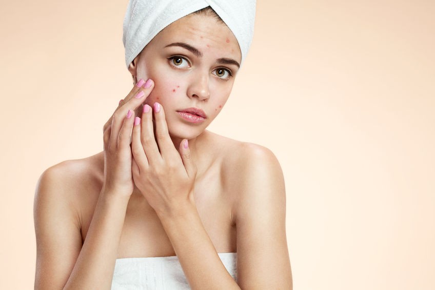 acne treatments near me