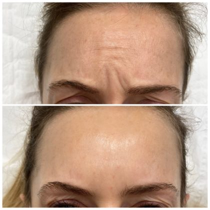 Pixel Perfect Aesthetic Clinics Near Me Pixel Perfect Aesthetic Clinics Near Me