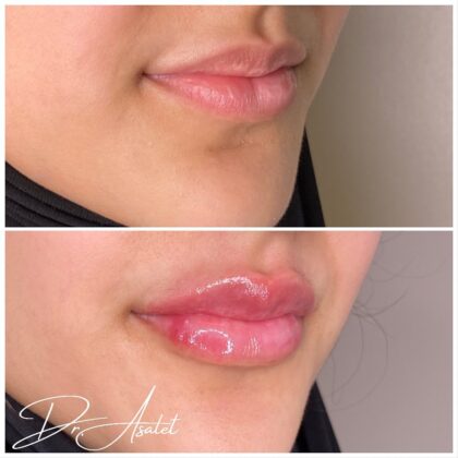 Pixel Perfect Aesthetic Clinics London Pixel Perfect Aesthetic Clinics London