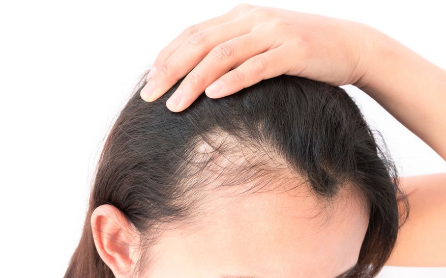 Platelet-rich plasma therapy (PRP) for hair loss near me
