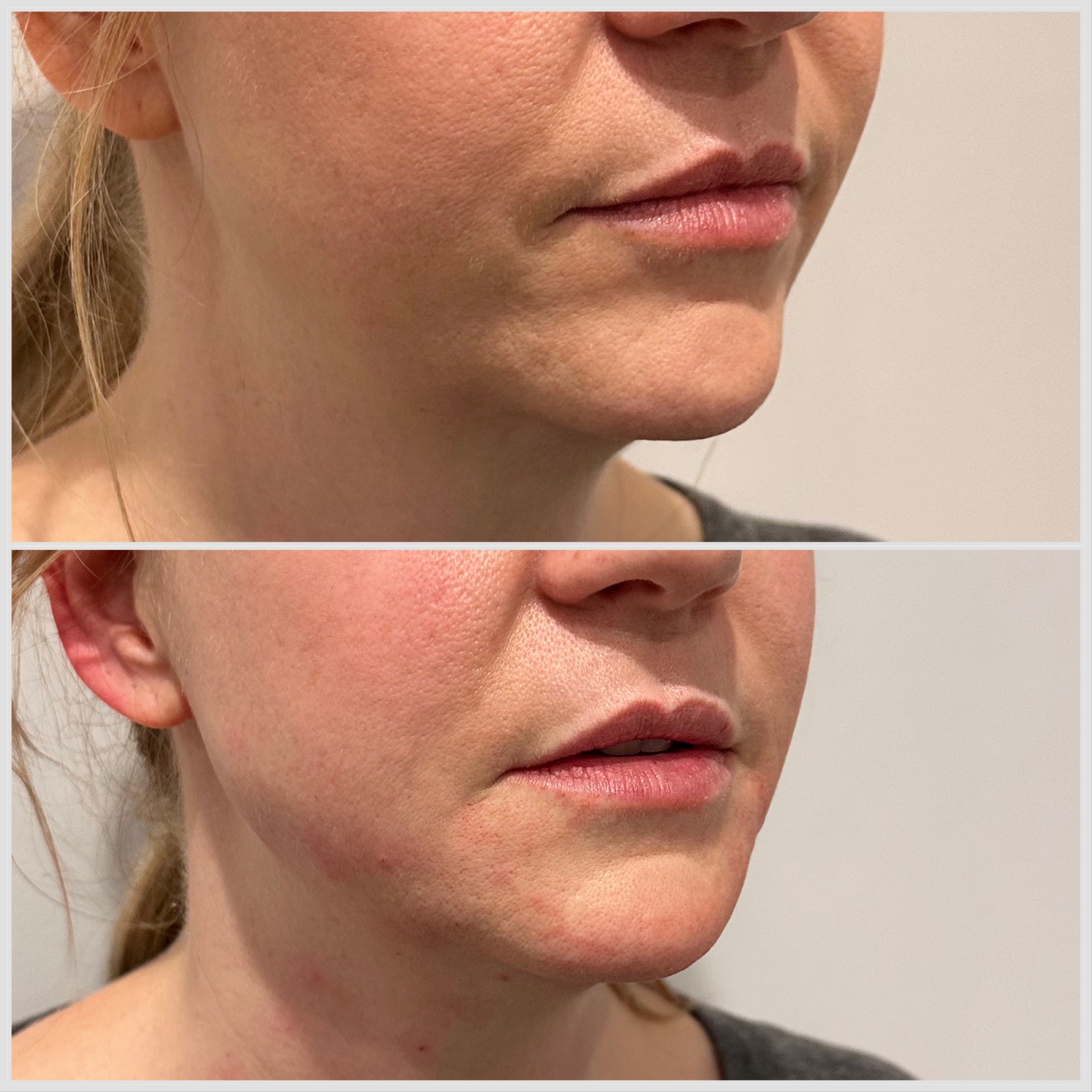 FDA approved products Dr Asalet in Southampton & Harley Street, London FDA approved products Dr Asalet in Southampton & Harley Street, London