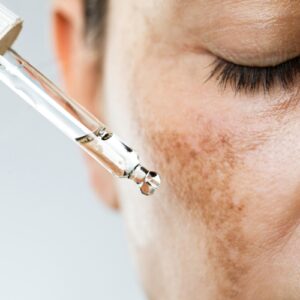 skin dry, dull or pigmented